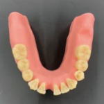 インプラント実習用歯科模型